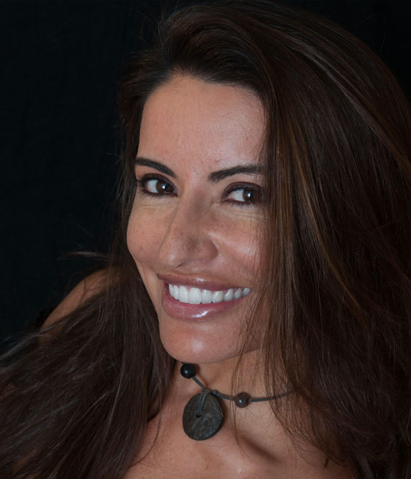 Dental Veneers