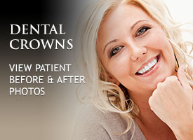 gallery-dental-crowns