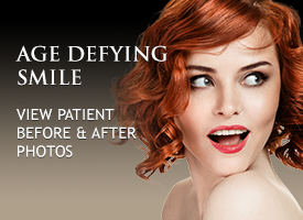 Veneers Orange County. Porcelain Veneers Orange County. Dental Veneers Orange County California.