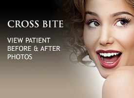 Invisalign Clear Braces in Irvine - Invisible Braces Irvine - Straight  Teeth Irvine