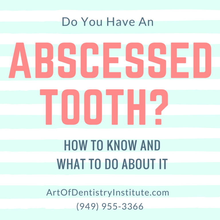 Do You Have An Abscess Tooth? What is it and what to do about it.