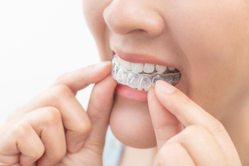 Invisalign Tips for Eating and Drinking
