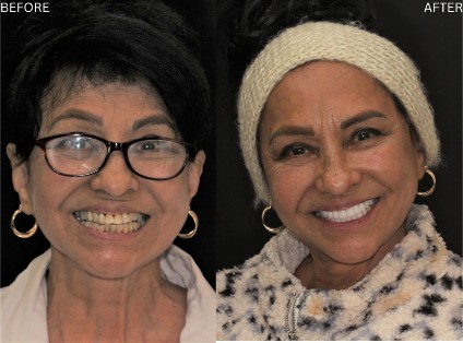 Age Defying Dentistry Patient 7