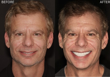 Age Defying Dentistry Patient 8