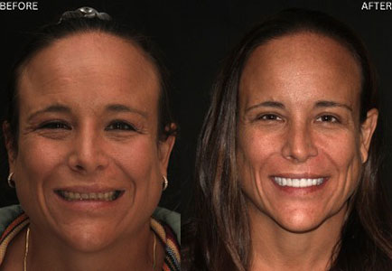 Age Defying Dentistry Patient 9