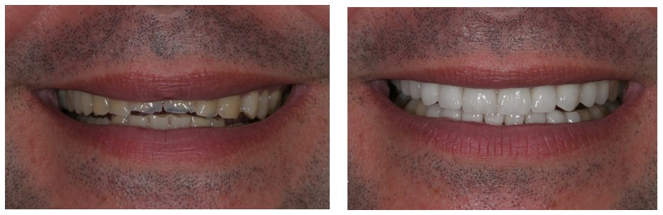 Age Defying Before After
