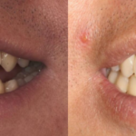 Patient 10 thumbnail