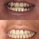 Patient 10 thumbnail