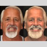 Anti aging 15 thumbnail