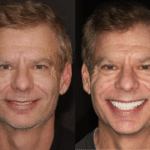 Anti Aging 37 thumbnail