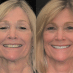 Anti Aging 10 thumbnail