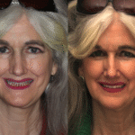 Anti Aging 7 thumbnail