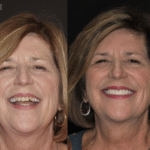 Anti Aging 13 thumbnail