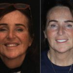 Anti aging 1 thumbnail