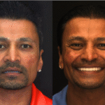 Anti Aging 5 thumbnail