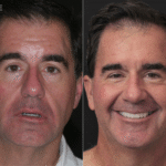 Anti Aging pt 22 thumbnail