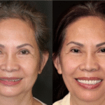 Anti aging 24 thumbnail