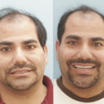 Anti Aging 27 thumbnail