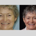 Anti aging 28 thumbnail