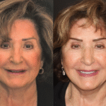 Anti Aging 8 thumbnail