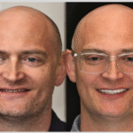 Anti aging 16 thumbnail