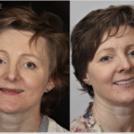 Anti Aging 17 thumbnail