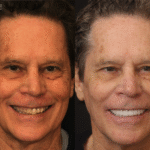 Anti Aging 19 thumbnail