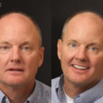 Anti Aging 20 thumbnail