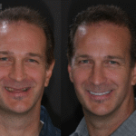 Anti agining 14 thumbnail