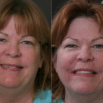 Anti Aging 32 thumbnail