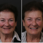 Anti Aging 34 thumbnail