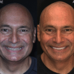 Anti Aging 2 thumbnail