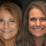 Anti Aging 9 thumbnail