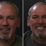 Anti Aging 36 thumbnail