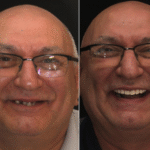 Anti aging 3 thumbnail