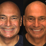 Anti Aging 2/ thumbnail