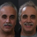 Anti Aging 35 thumbnail