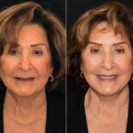 Anti Aging 8 thumbnail