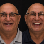 Anti aging 3 thumbnail