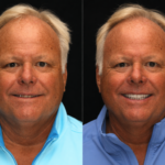 Anti Aging 6 thumbnail
