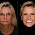 Anti aging 12 thumbnail