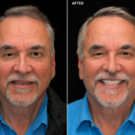 Anti Aging 11 thumbnail