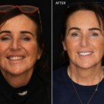 Anti aging 1 thumbnail
