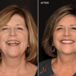 Anti Aging 13 thumbnail
