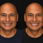 Anti Aging 2/ thumbnail