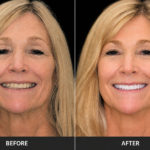 Anti Aging 10 thumbnail