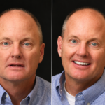 Anti Aging 20 thumbnail