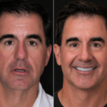 Anti Aging pt 22 thumbnail