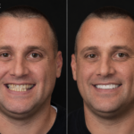 Anti aging 24 thumbnail