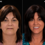 Anti Aging 26 thumbnail